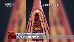 该当间接触发高风险的审核